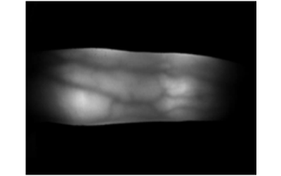 A Study on Touchless Finger Vein Recognition Robust to the Alignment and Rotation of Finger, Thumbnail