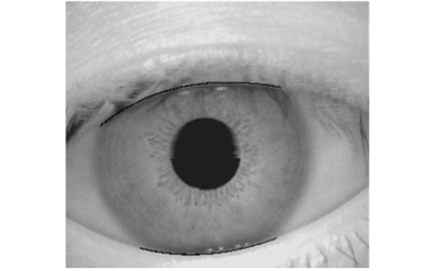 A Study on Eyelid Localization Considering Image Focus for Iris Recognition Representative