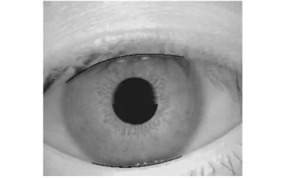 A Study on Eyelid Localization Considering Image Focus for Iris Recognition Representative