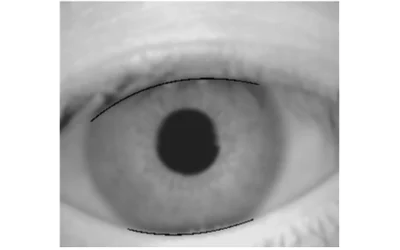 A Study on Eyelid Localization Considering Image Focus for Iris Recognition Thumbnail